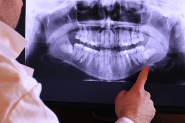 Best Broken or Cracked Tooth Emergency Dentist in Pell City, AL